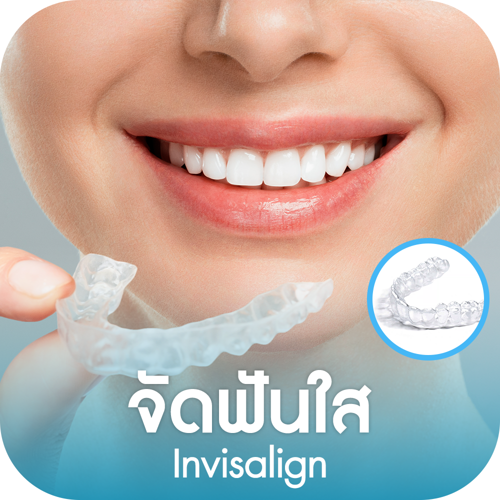 จัดฟันใส